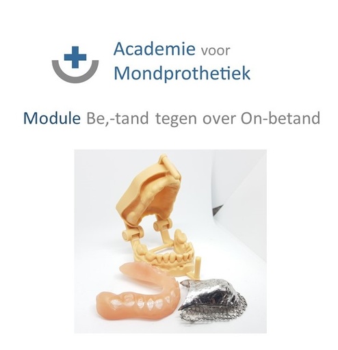 [AvM-MD-EP] MoDule Enkele Prothese (betand / onbetand)