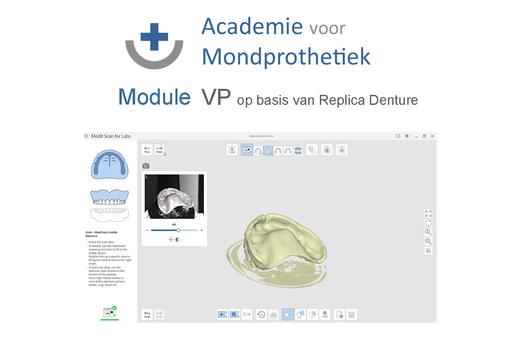 [AvM-MD-RD] MoDule Volledige prothese op basis van een Replica Denture