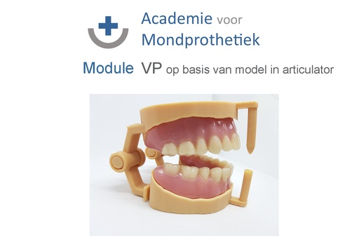 [AvM-MD-VP] MoDule Volledige Prothese op basis van een model in articula
